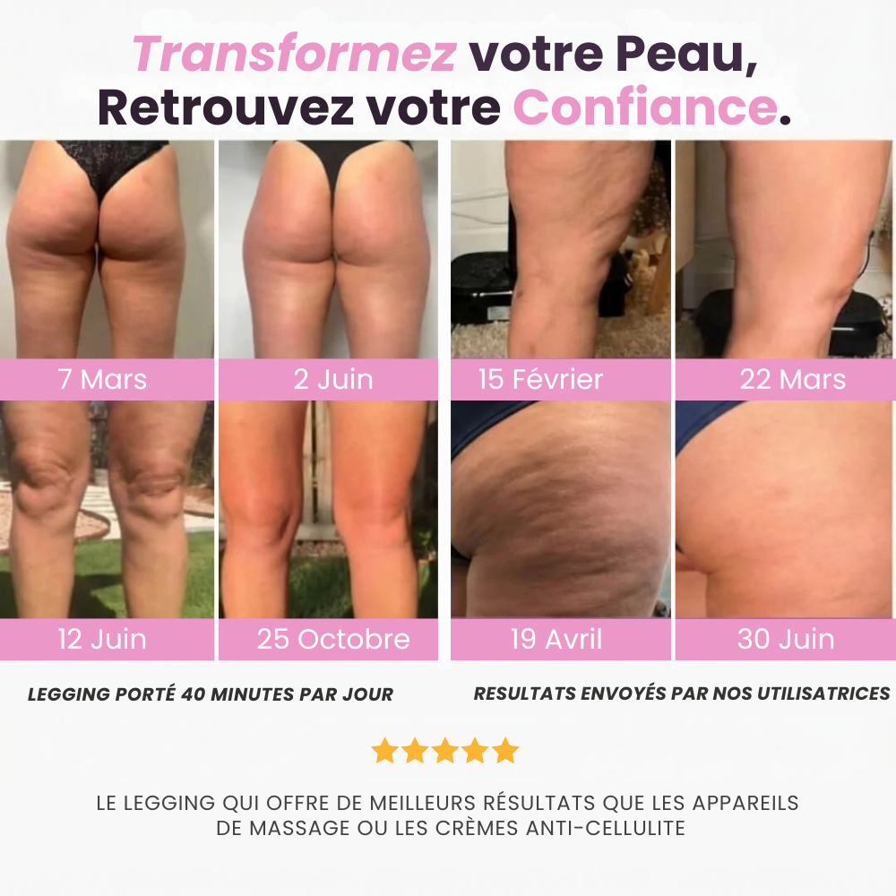 Leggings 3D - ANTI CELLULITE