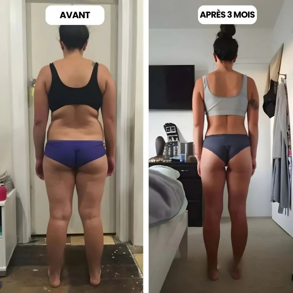 Leggings 3D - ANTI CELLULITE